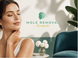 https://www.moleremovalsacramento.com/ website